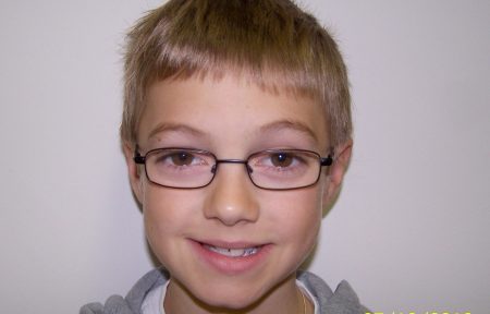 Young patient requiring orthodontic treatment at Smile101